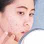 4 Top Skin break out&nbsp;Medicines