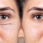 Tired Eyes Making You Look Exhausted? Real Solutions That&nbsp;Work