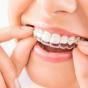 A Clearer Way to Improve Your&nbsp;Smile