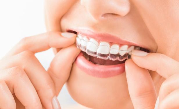 A Clearer Way to Improve Your&nbsp;Smile